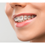 mersin-en-iyi-ortodontist
