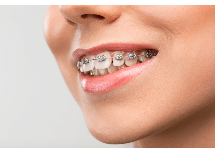 mersin-en-iyi-ortodontist